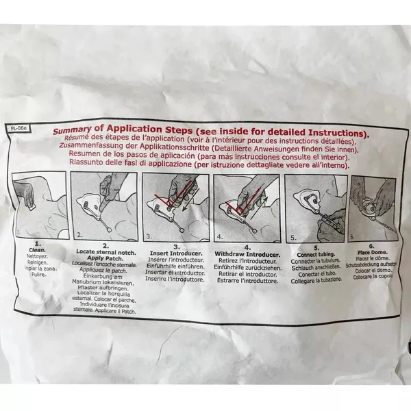 FAST1 Intraosseous Infusion System - Image 8