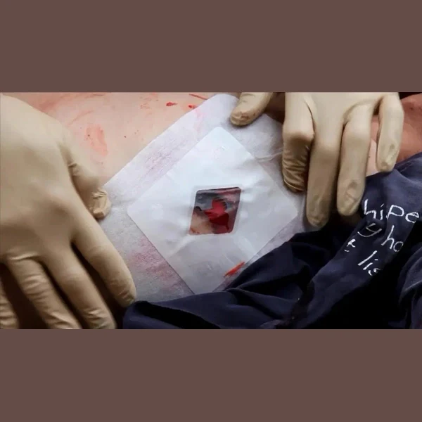 Russell Chest Seal - Image 4