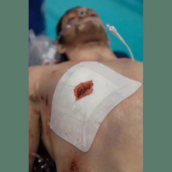 Russell Chest Seal - Image 5
