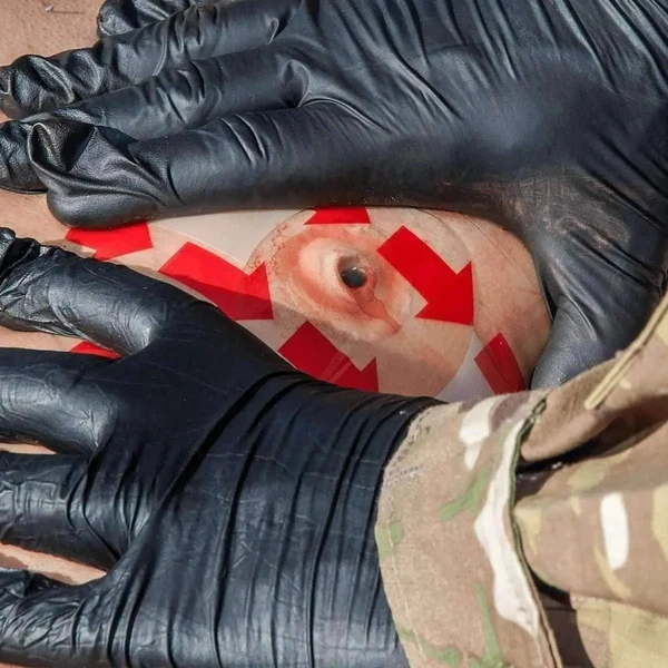 SENTINEL Chest Trauma Kit - Image 3