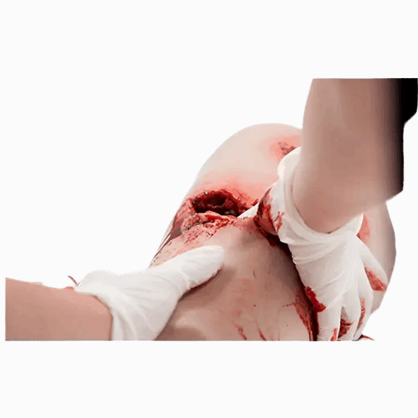 Simbodies Thigh Wound Packing Trainer - Image 3