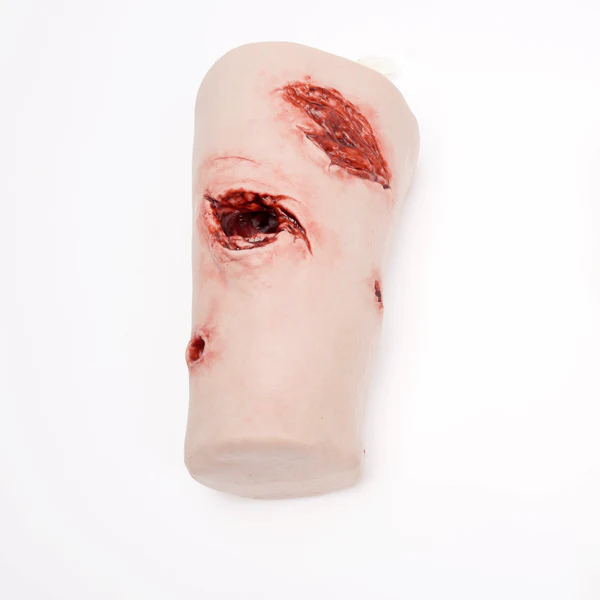 Thigh Packing Wound - Image 2