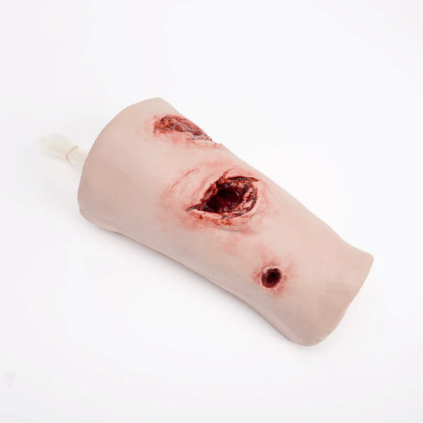 Thigh Packing Wound - Image 3