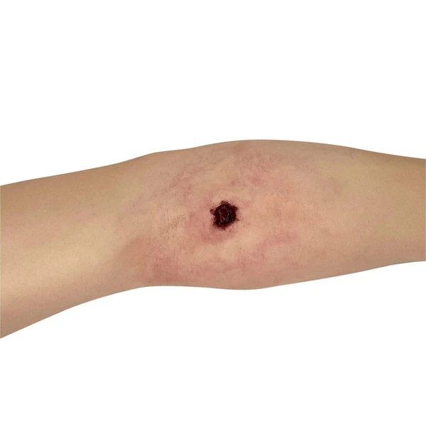 Tourniquet Arm Trainer - Image 5