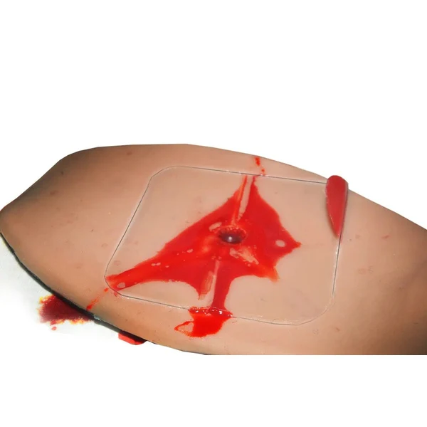 TrueClot® Chest Seal Application Training System - Image 4