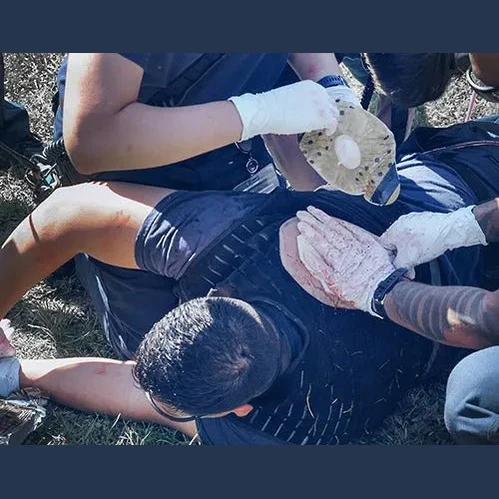 TrueClot® Chest Seal Application Training System - Image 7